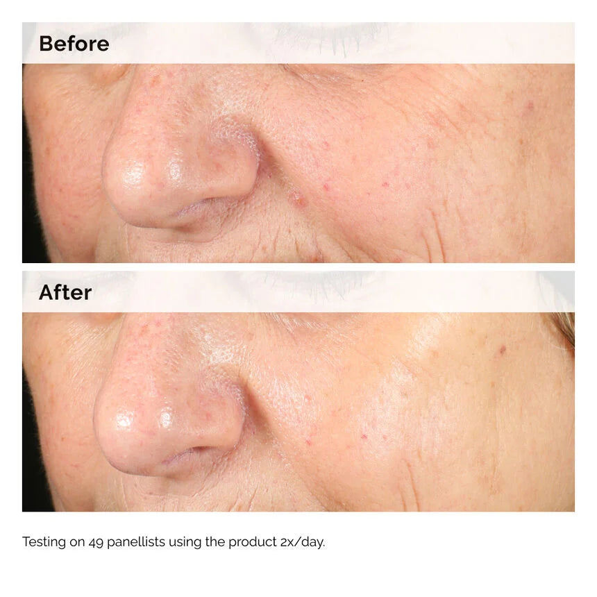 Alpha Arbutin 2% + HA | THE ORDINARY