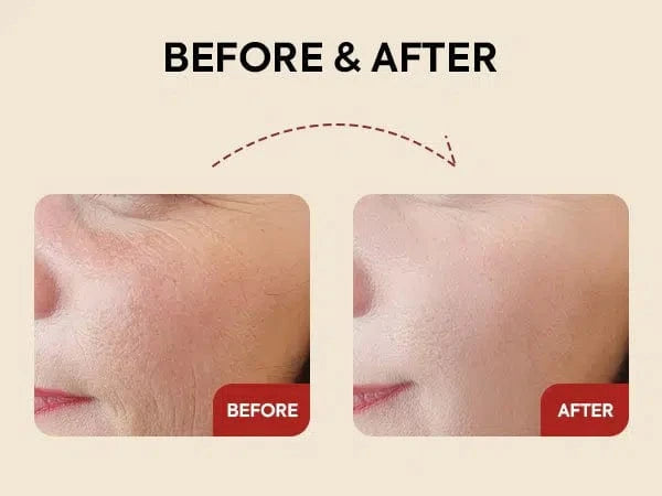 KSecret - Seoul 1988 Serum: Retinal Liposome 2% + Black Ginseng